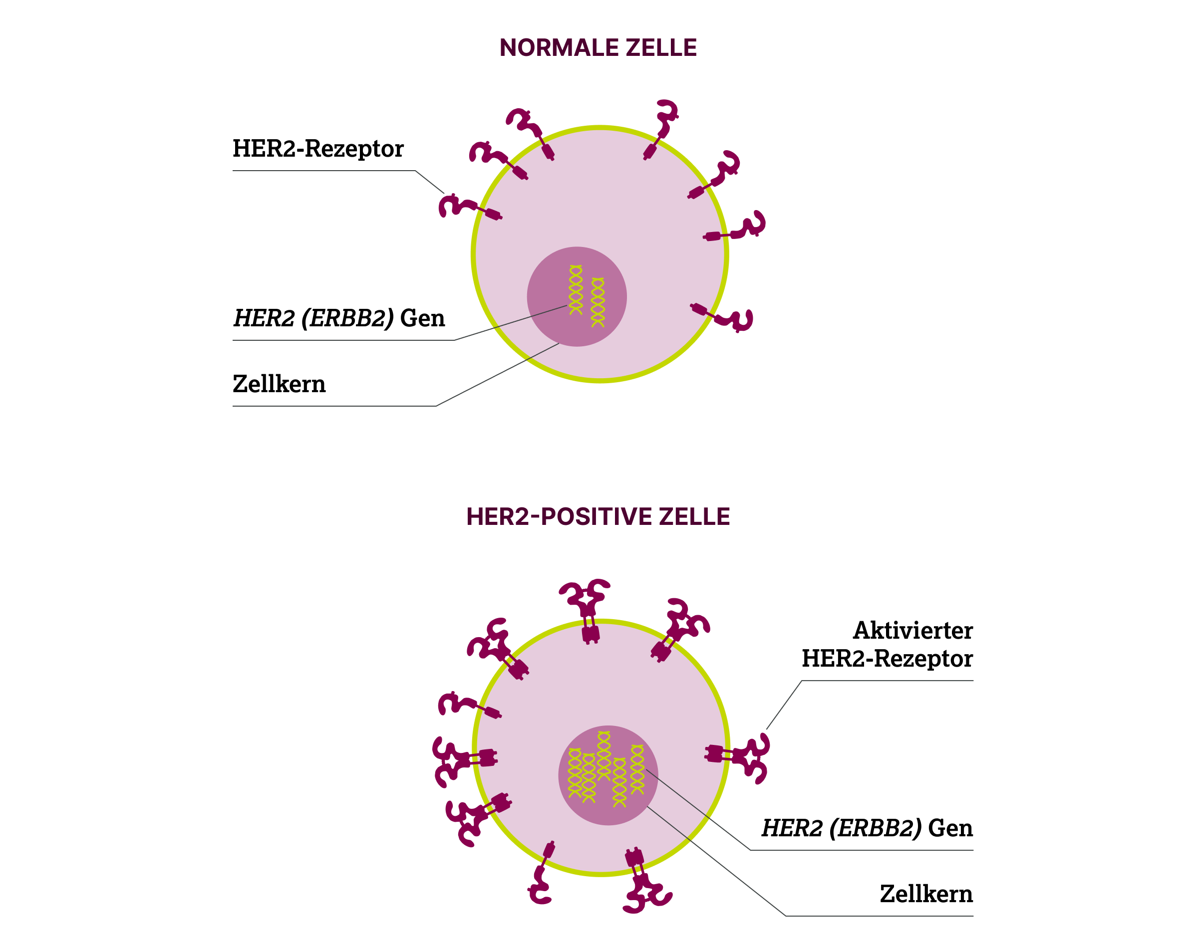 2.2.2-02-biomarker-HER2-grafik-expression-normale-zelle-tumorzelle-1.webp
