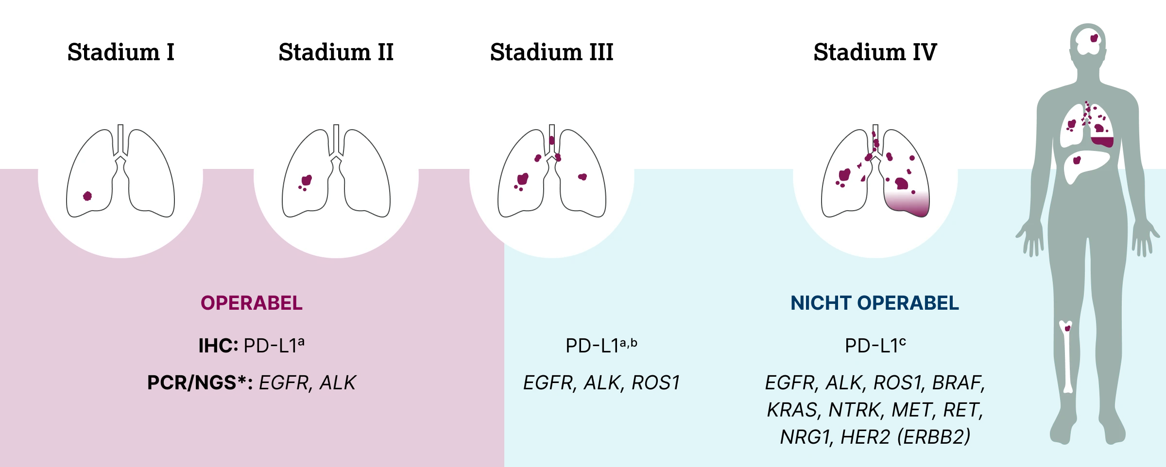 1.2.3-05-tumorerkrankungen-PD-L1-Lunge-grafik-empfehlungen-biomarkerdiagnostik-2x.webp