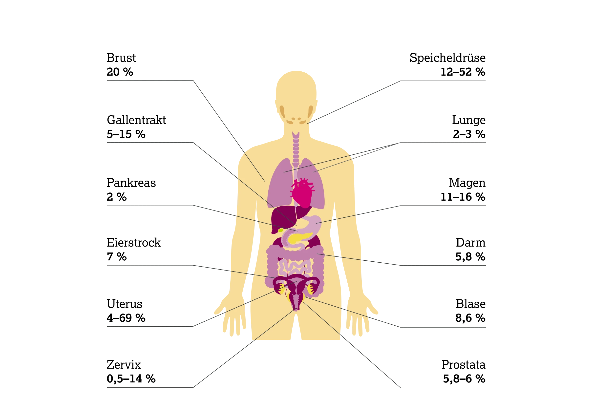 2.2.2-01-biomarker-HER2-grafik-praevalenz-amplifikation2x.webp