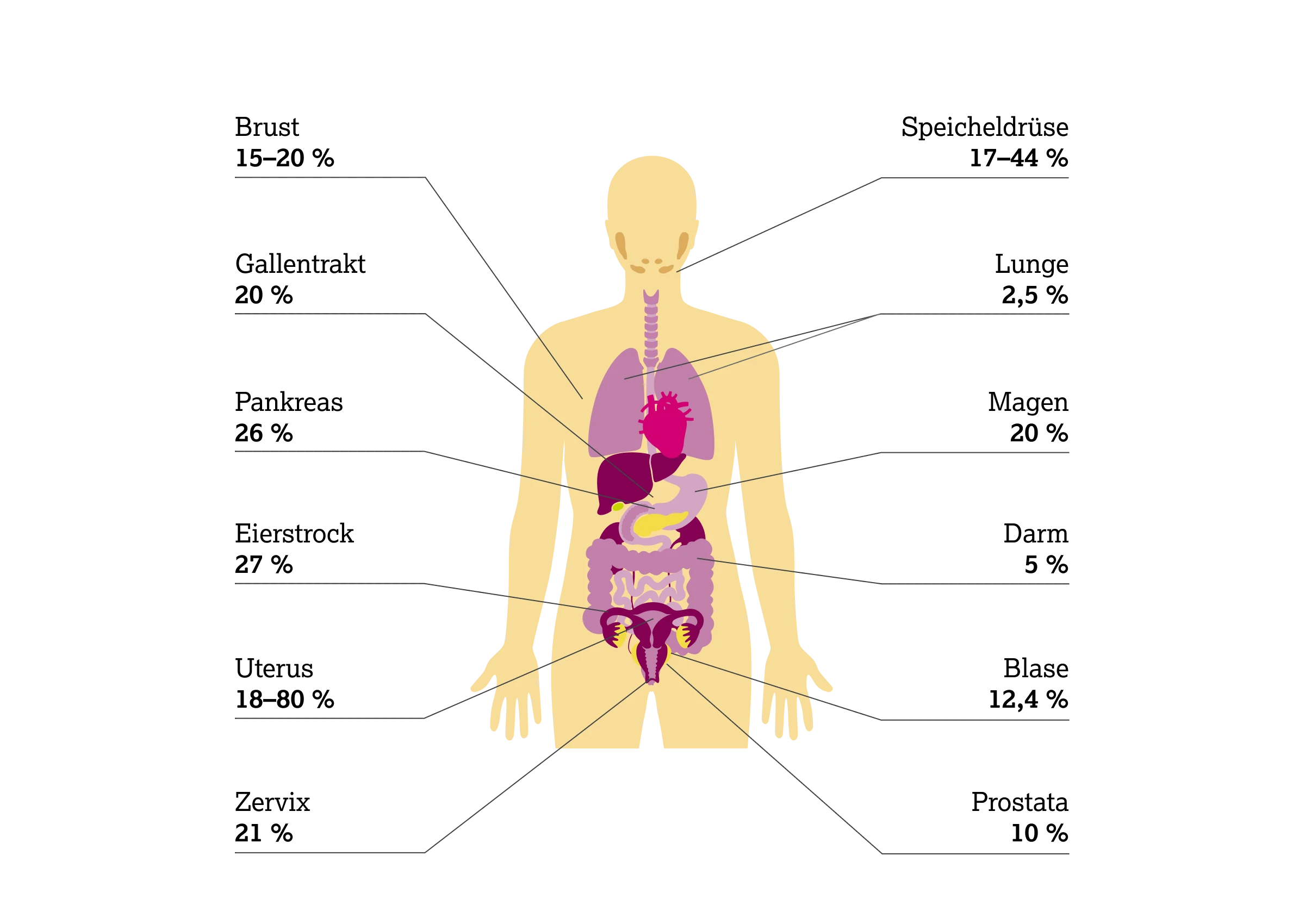 2.2.2-01-biomarker-HER2-grafik-praevalenz-ueberexpression2x.webp