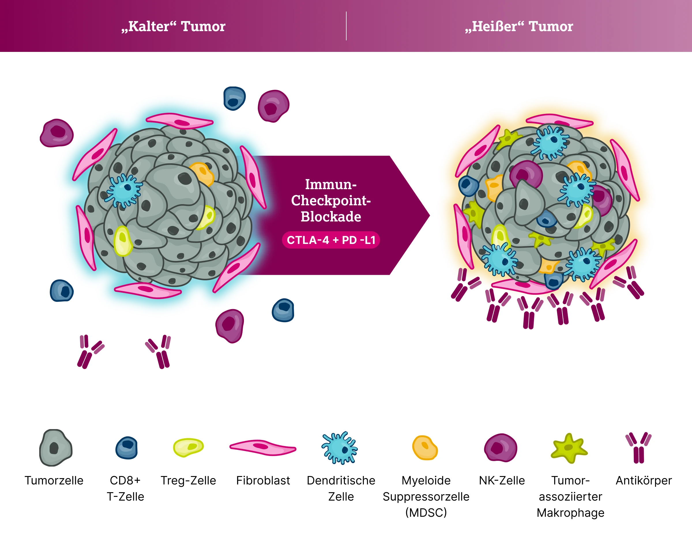 3.4.2-03-diagnostik-therapie-umwandlung-kalter-heisse-tumor2x.webp