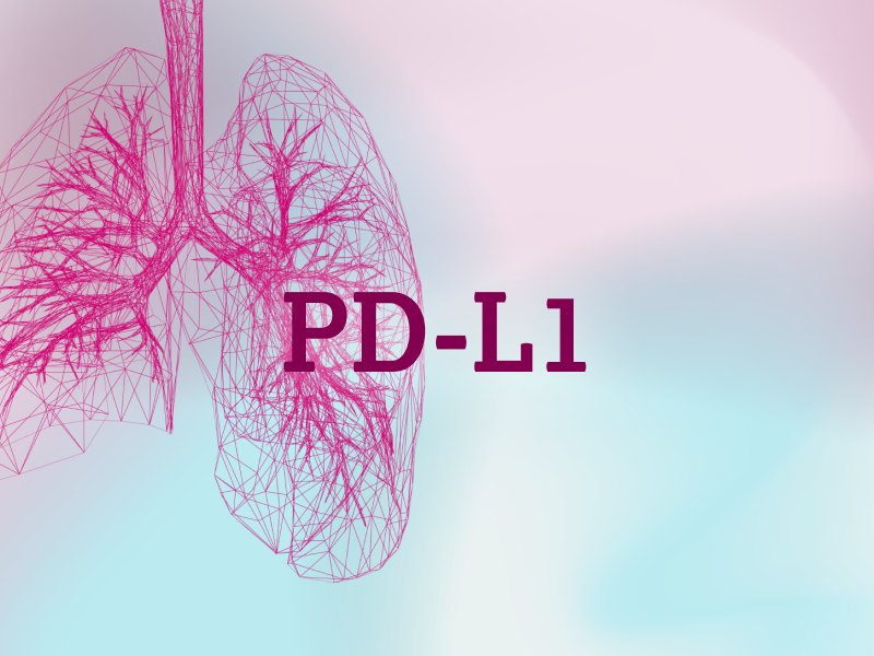 teaser-lung-ebene-2-PDL1-2x_uid_69d4f9b6a51cd.webp