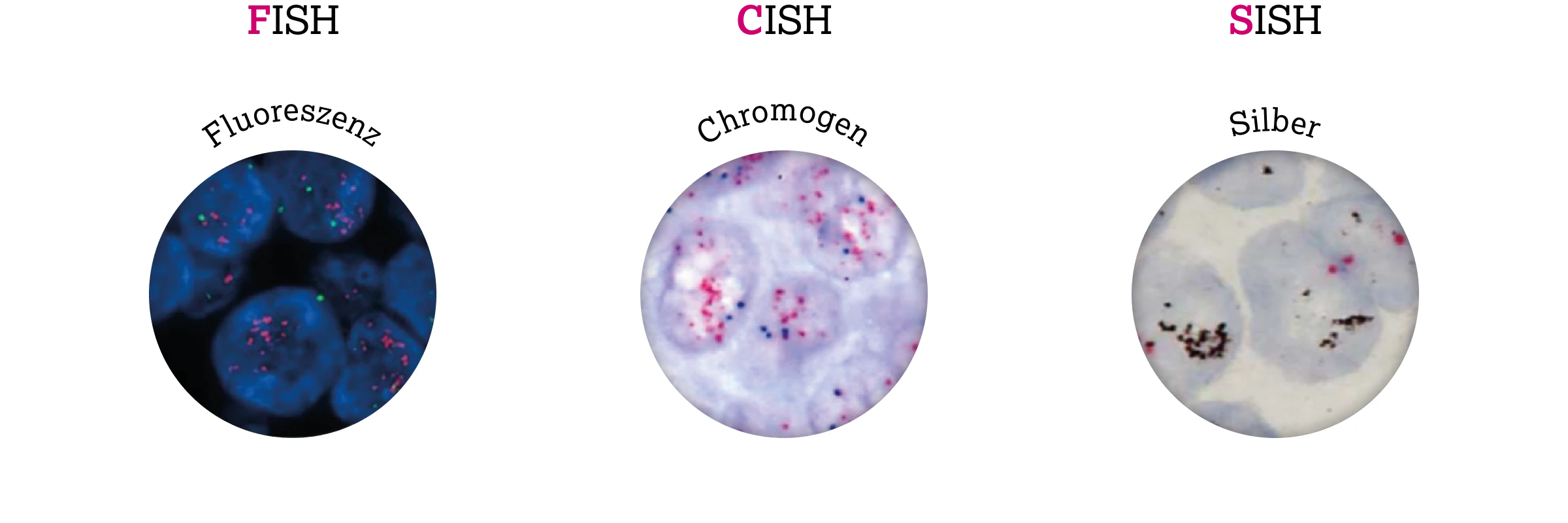 3.2.1-02-diagnostik-therapie-HER2-grafik-In-situ-Hybridisierungs-Verfahren2x.webp