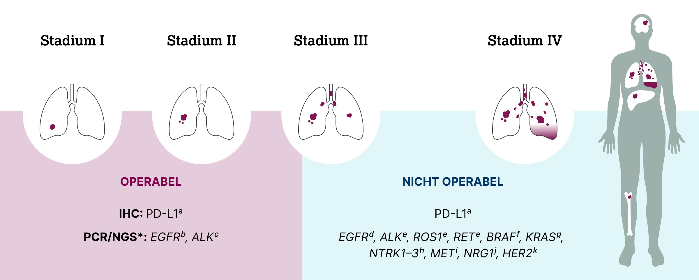 1.2.2-02-tumorerkrankungen-EGFR-Lunge-grafik-biomarkertestungen-2x.webp